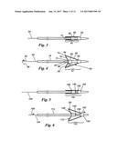 PERCUTANEOUS TRANSLUMINAL ANGIOPLASTY DEVICE WITH INTEGRAL EMBOLIC FILTER diagram and image