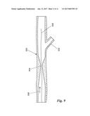 PERCUTANEOUS TRANSLUMINAL ANGIOPLASTY DEVICE WITH INTEGRAL EMBOLIC FILTER diagram and image