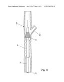 PERCUTANEOUS TRANSLUMINAL ANGIOPLASTY DEVICE WITH INTEGRAL EMBOLIC FILTER diagram and image