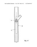 PERCUTANEOUS TRANSLUMINAL ANGIOPLASTY DEVICE WITH INTEGRAL EMBOLIC FILTER diagram and image