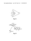 PERCUTANEOUS TRANSLUMINAL ANGIOPLASTY DEVICE WITH INTEGRAL EMBOLIC FILTER diagram and image