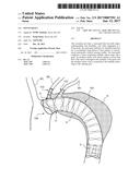 STENT-GRAFT diagram and image