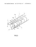 STENT-GRAFT diagram and image