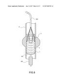 STENT-GRAFT diagram and image