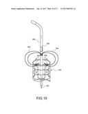 STENT-GRAFT diagram and image