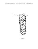 ENDOPROSTHESIS FOR ENDOVASCULAR TREATMENT OF THORACIC-ABDOMINAL AORTIC     ANEURYSMS OR DISSECTIONS AND ENDOPROSTHESIS FOR ENDOVASCULAR TREATMENT OF     ABDOMINAL AORTIC ANEURYSMS OR DISSECTIONS WHICH COMPROMISE THE ILIAC     ARTERIES diagram and image