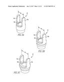 SOFT TISSUE REPAIR METHOD diagram and image