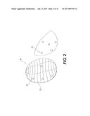 Breast Prostheses, Methods of Manufacturing Breast Prostheses, and Methods     of Treatment Using Breast Prostheses diagram and image