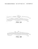 Breast Prostheses, Methods of Manufacturing Breast Prostheses, and Methods     of Treatment Using Breast Prostheses diagram and image