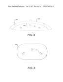 Breast Prostheses, Methods of Manufacturing Breast Prostheses, and Methods     of Treatment Using Breast Prostheses diagram and image