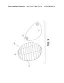 Breast Prostheses, Methods of Manufacturing Breast Prostheses, and Methods     of Treatment Using Breast Prostheses diagram and image