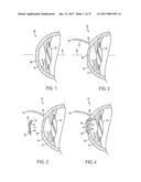 METHOD OF ALTERING THE REFRACTIVE PROPERTIES OF AN EYE diagram and image