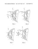 METHOD OF ALTERING THE REFRACTIVE PROPERTIES OF AN EYE diagram and image