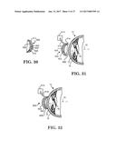 METHOD OF ALTERING THE REFRACTIVE PROPERTIES OF AN EYE diagram and image