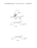 METHOD OF ALTERING THE REFRACTIVE PROPERTIES OF AN EYE diagram and image