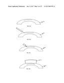 METHOD OF ALTERING THE REFRACTIVE PROPERTIES OF AN EYE diagram and image