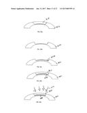 METHOD OF ALTERING THE REFRACTIVE PROPERTIES OF AN EYE diagram and image