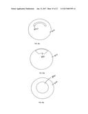 METHOD OF ALTERING THE REFRACTIVE PROPERTIES OF AN EYE diagram and image