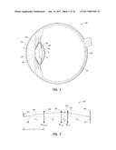 SYSTEM, OPHTHALMIC LENS, AND METHOD FOR EXTENDING DEPTH OF FOCUS diagram and image