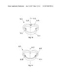 Heart Valve Assemblies diagram and image