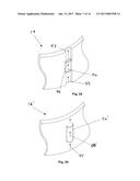 Heart Valve Assemblies diagram and image