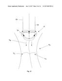 Heart Valve Assemblies diagram and image