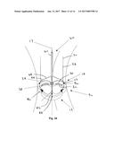 Heart Valve Assemblies diagram and image