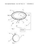 ADJUSTABLE ANNULOPLASTY DEVICE diagram and image