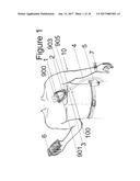 IMPLANTABLE DEVICE FOR THE LOCATIONALLY ACCURATE DELIVERY AND     ADMINISTRATION OF SUBSTANCES INTO THE PERICARDIUM OR ONTO THE SURFACE OF     THE HEART diagram and image