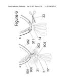 IMPLANTABLE DEVICE FOR THE LOCATIONALLY ACCURATE DELIVERY AND     ADMINISTRATION OF SUBSTANCES INTO THE PERICARDIUM OR ONTO THE SURFACE OF     THE HEART diagram and image