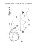 IMPLANTABLE DEVICE FOR THE LOCATIONALLY ACCURATE DELIVERY AND     ADMINISTRATION OF SUBSTANCES INTO THE PERICARDIUM OR ONTO THE SURFACE OF     THE HEART diagram and image