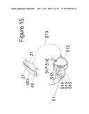 IMPLANTABLE DEVICE FOR THE LOCATIONALLY ACCURATE DELIVERY AND     ADMINISTRATION OF SUBSTANCES INTO THE PERICARDIUM OR ONTO THE SURFACE OF     THE HEART diagram and image