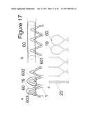 IMPLANTABLE DEVICE FOR THE LOCATIONALLY ACCURATE DELIVERY AND     ADMINISTRATION OF SUBSTANCES INTO THE PERICARDIUM OR ONTO THE SURFACE OF     THE HEART diagram and image