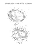 IMPLANTING CARDIAC DEVICES diagram and image