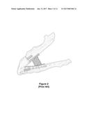 SURGICAL IMPLANTS diagram and image