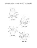 Joint Arthroplasty Devices and Surgical Tools diagram and image