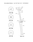 Joint Arthroplasty Devices and Surgical Tools diagram and image