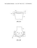 Joint Arthroplasty Devices and Surgical Tools diagram and image