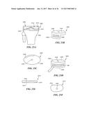 Joint Arthroplasty Devices and Surgical Tools diagram and image