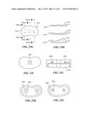 Joint Arthroplasty Devices and Surgical Tools diagram and image