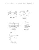 Joint Arthroplasty Devices and Surgical Tools diagram and image