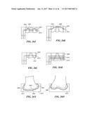 Joint Arthroplasty Devices and Surgical Tools diagram and image