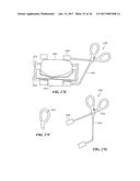 Joint Arthroplasty Devices and Surgical Tools diagram and image