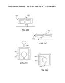 Joint Arthroplasty Devices and Surgical Tools diagram and image