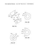 Joint Arthroplasty Devices and Surgical Tools diagram and image