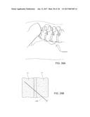 SYSTEMS, DEVICE, AND METHODS FOR JOINT FUSION diagram and image