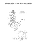 SYSTEMS, DEVICE, AND METHODS FOR JOINT FUSION diagram and image