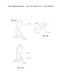 SYSTEMS, DEVICE, AND METHODS FOR JOINT FUSION diagram and image