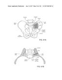 SYSTEMS, DEVICE, AND METHODS FOR JOINT FUSION diagram and image