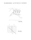 SYSTEMS, DEVICE, AND METHODS FOR JOINT FUSION diagram and image